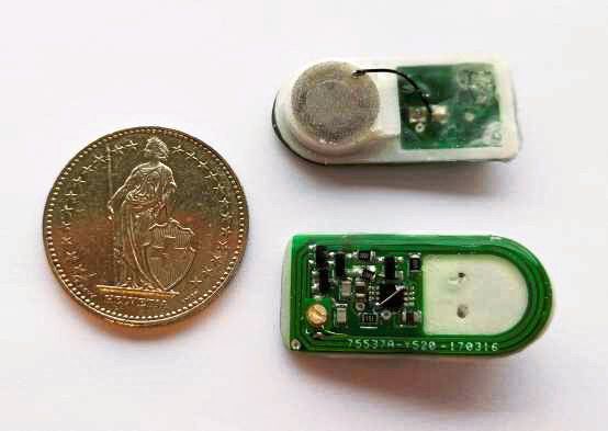Prototyp des Implantats: Ein Kabel verbindet die runde zellengefüllte Kammer mit der Steuerungselektronik (grün). Das gesamte Konstrukt ist etwas so gross wie ein Schweizer Zweifranken-​Stück.