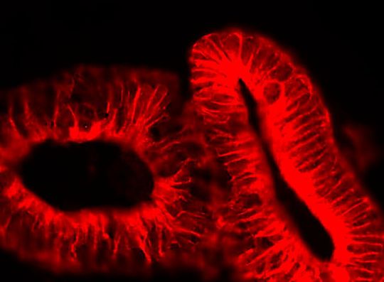 Auch an Darmorganoiden wurde die zellschützende Wirkung von Amiodaron getestet.(Bild:  doi.org/10.1080/19490976.2023.2256695)