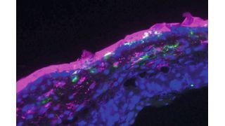Fluoreszenzmikroskopische Aufnahme der mit Aptamercreme behandelten Haut: Die Aptamere (hier pink markiert) wurden in Form einer Salbe auf die oberste Hautschicht aufgetragen und drangen auch in tiefere Hautschichten ein (Zellkerne: blau; Antigen-präsentierende Zellen: grün). (Bild: Marlene Gottschalk)