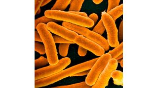 Microscopic image of E. coli bacteria.  (Source: National Institutes of Health)