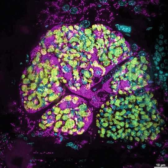 Visualisierung von Bakterien mittels Fluoreszenz-in-situ-Hybridisierung: Zu sehen ist ein mit Sodalis praecaptivus (in Magenta) infiziertes Bakteriom in einem Getreideplattkäfer Oryzaephilus surinamensis der ersten Nachkommengeneration. Der ursprüngliche Symbiont Shikimatogenerans ist in Gelb markiert.(Bild:  Ronja Krüsemer, Max-Planck-Institut für chemische Ökologie)