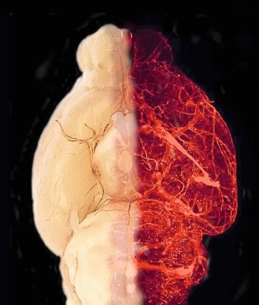 Blutgefäße im transparent erscheinenden Gehirn eines adipösen Mausmodells (Tim Gruber)