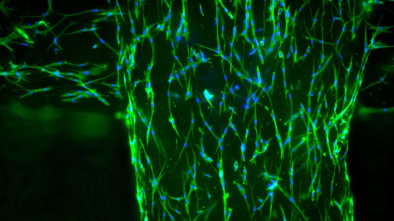 Im Projekt PhysioINK entwickeln Fraunhofer-Forschende Bio-Drucktinten aus den gängigsten Gewebeproteinen. Unter dem Mikroskop sind die lebenden Gewebezellen (Fibroblasten) in der gedruckten Gitterstruktur erkennbar: Blau ist der Zellkern, grün das Zytoskelett.(Bild:  Tobias Weigel/Fraunhofer ISC)