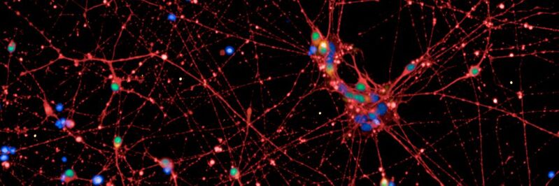 Aus menschlichen Stammzellen hergestellte Nervenzellen (rot und grün). In orange markierten Zellen ist das Sättigungsgen POMC aktiv. Blau: Zellkerne. 