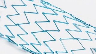 POSITIVE COATING - STENT.jpg (Positive Coating SA)