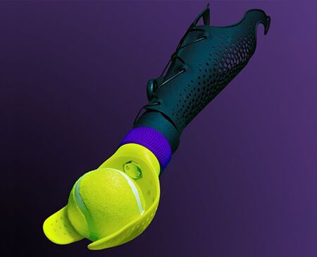 Die individuell 3D-gedruckte Unterarmprothetik macu4 ist modular aufgebaut. Ihr Schaft kann mit verschiedenen funktionalen Händen kombiniert werden. (Bild: macu4 AG/Purmundus Challenge)