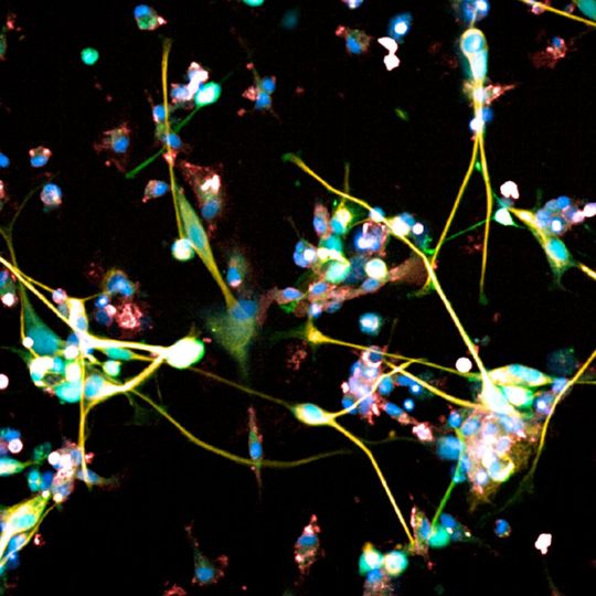 Glioblastoma cells under the microscope(Source:  Sohyon Lee & Berend Snijder ETH Zurich)