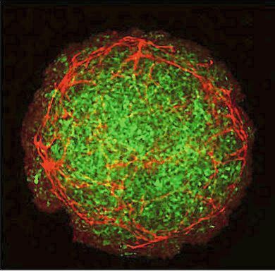 Organoidmodelle mit einer teils verblüffenden Ähnlichkeit zu echten embryonalen Geweben: Tumor-Organoid mit Blutgefäßen (rot) und Tumorzellen (grün) (JMU, Institut für Anatomie und Zellbiologie)