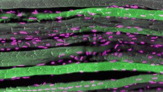 Sport lässt die Muskeln wachsen, aber die Frage, was auf molekularer Ebene passiert, ist bislang nicht eindeutig geklärt. Wissenschaftler aus Basel haben nun die Rolle des „Wachstums-Proteins“ Myc neu untersucht. Das Bild zeigt einen Gewebeschnitt vielkerniger Muskelfasern (grün, Zellkerne in pink).  (Bild: DOI: 10.1038/s41467-025-58542-7)