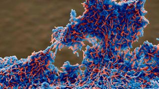 Das Foto zeigt die Co-Aggregation von Pylopass (blau) und Helicobacter pylori (rot). Rasterelektronenmikroskop-Aufnahme (REM) in 1800-facher Vergrößerung. (Organobalance)