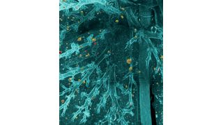 DeepMACT nutzt künstliche Intelligenz, um selbst kleinste Metastasen im gesamten Mauskörper zu erkennen. Im Bild sind einzelne disseminierter Zellen in der Lunge zu sehen.  (©Helmholtz Zentrum München)