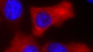 Das Bild zeigt eine Immunfluoreszenz-Aufnahme von TSC22D4 (rot) exprimierenden Zellen. (Helmholtz Zentrum München)