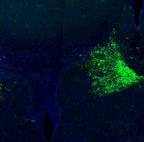 Most of the brain’s noradrenaline is produced by the two locus coeruleus nuclei, one in each brain hemisphere. The neurons of the locus coeruleus are labeled with green fluorescent protein.