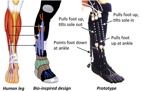 Mit dem Roboter lassen sich die Füße gelähmter Personen bewegen. (cmu.edu)
