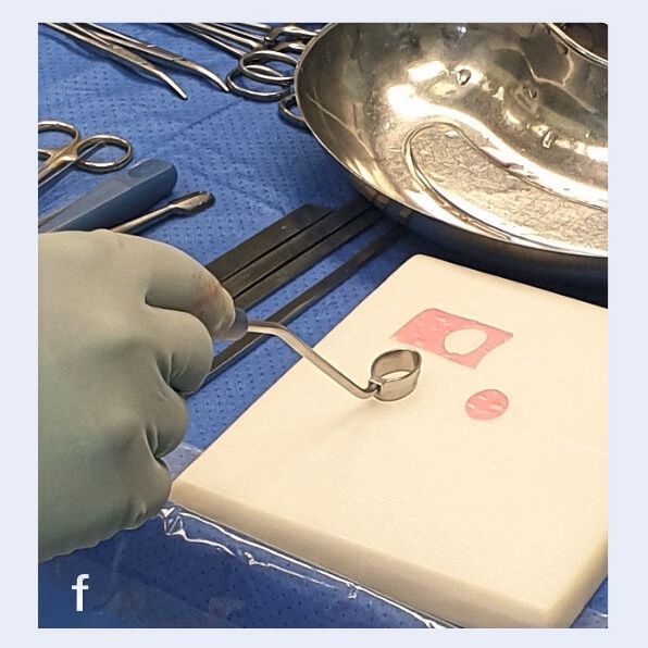 Im OP der Orthopädischen Universitätsklinik Würzburg wird das fertige Knorpelimplantat N-TEC auf die richtige Größe ausgestanzt. (Bild: TERM / UKW)