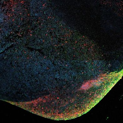Mithilfe von Hirnorganoiden haben Forschende wertvolle Einblicke in die Mechanismen gewonnen, wie sich das Ebola-Virus im Zentralnervensystem verstecken und dort persistieren kann. (Bild: ©BNITM | Lina Widerspick)