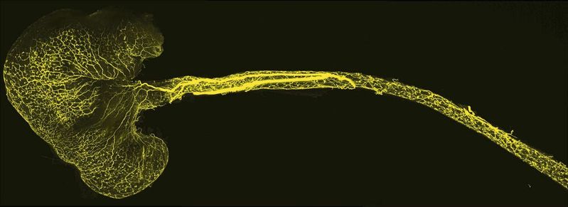 Aufnahme von Speiseröhre und Magen einer Maus: Die Fortsätze der sensorischen Neuronen, die zu einem Nervenzellknoten des Vagusnervs (vagales Ganglion) gehören, hat das Forscherteam mit einem fluoreszierenden Farbstoff markiert. Ein mesoSPIM-Mikroskop (Lichtscheiben-Mikroskopie) machte die Axone sichtbar.