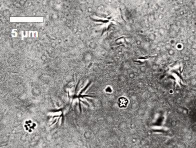 Kutikuläre Kohlenwasserstoffe bilden eine Mischung aus flüssigen und festen Anteilen. Kohlenwasserstoffe der Ameise Myrmica rubra können sogar Kristalle bilden – unter dem Mikroskop als sternartige Strukturen zu sehen. (Bérengère Abou)