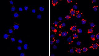Die Aktivierung des Immunrezeptors TREM-1 führt zur vermehrten Aufnahme und Akkumulation von Lipiden in Monozyten und Makrophagen und zu deren Differenzierung in Schaumzellen Bei fettreicher Ernährung wird der Rezeptor TREM-1 vermehrt auf der Oberfläche von Monozyten und Makrophagen exprimiert. Wird dieser Rezeptor aktiviert (rechtes Bild), treten auf diesen Zellen zunehmend „Scavenger“-Rezeptoren auf, die effizient Lipidmoleküle aus der Umgebung aufnehmen und in Form von Lipidtröpfchen (rot gefärbt) im Zellinnern speichern („Schaumzellen“). (Universität Bern)