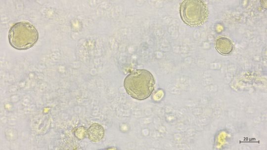 Abb. 3: Pollen einer Linde, aufgenommen mit ZEISS Axiolab 5 im Hellfeld, Objektiv: 40×(Bild:  ZEISS Microscopy)