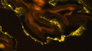 Die Fluoreszenz-in-situ-Hybridisierung (FISH) zeigt, dass bakterielle Enterococcus Zellen (gelb) in hoher Dichte an der Schleimschicht kleben, die die Darmwand überzieht. (Yongqi Shao, Universität Zhejiang, Hangzhou, China)