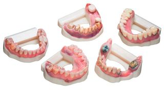 Die neuste Version der Software Dental System (2022.1) unterstützt das offene Dateiformat 3MF und erfasst geometrische und farbliche Daten aus intraoralen Scans. Mit diesen Daten können Vollfarb-Zahnmodelle auf dem J5 Denta-Jet gedruckt werden. (Bild: Smile Designs By Rego)