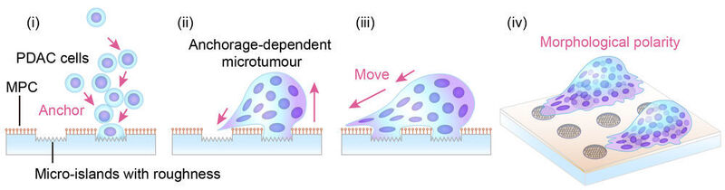 In the newly developed culture system, the pancreatic cancer cells (PDAC) self-organized and anchored to the micro-scale islands. Anchorage-dependent pancreatic cancer micro-tumors showed morphological polarity and motility. Arrows indicate presumed direction of movement. (Miyatake Y. et al./ Hokkaido University)