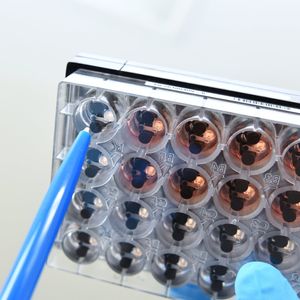 In diesem Trägersystem werden die Muskelorganoide gezüchtet.(Bild:  Bergmannsheil)