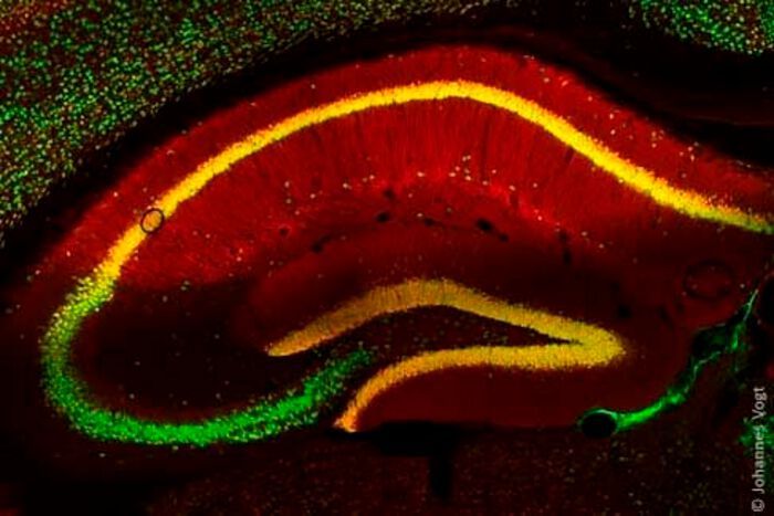 Nerve cells of a mouse brain (green) and the protein PRG-1 (red). If the nerve cells contain PRG-1, the cells appear in yellow.