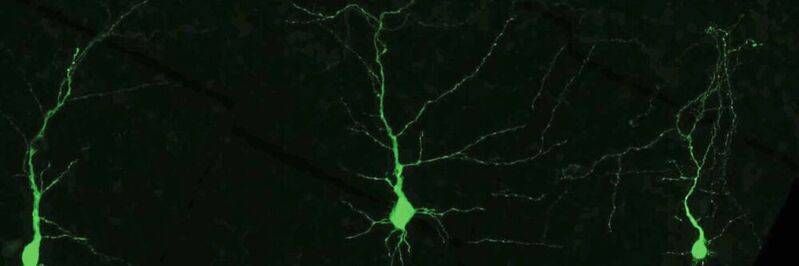 Neuronen der Großhirnrinde – die äußerste Schicht des Gehirns: Entzieht man Neuronen bestimmte Aminosäuren während der Gehirnentwicklung, hat dies schwerwiegende Folgen für Mäuse nach der Geburt.