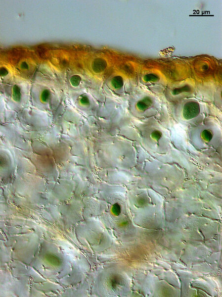 In der Gallertflechte Paulia perforata sind Blaugrüne Felskugeln (Chroococcidiopsis) in eine umgebende Hülle aus Pilzfäden und gallertiger Substanz eingebettet. Dort stellt sie dem Pilzpartner Nährstoffe zur Verfügung, die sie durch Photosynthese aufbauen konnte. Der Pilz gewährt der Felskugel dafür Schutz und optimale räumliche Anordnung in seinem Inneren. Fundort Yemen, Insel Socotra, Sommerregenzone, auf steilen Kalkfelsflächen. (Matthias Schultz, Univ. Hamburg)