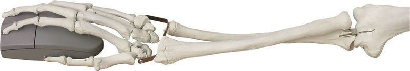 Die vertikale Position der Hand mit der VerticalMouse von Evoluent verhindert ein Verdrehen des Unterarmes und beugt so Verspannungen und dem so genannten Maus-Arm vor. (Archiv: Vogel Business Media)