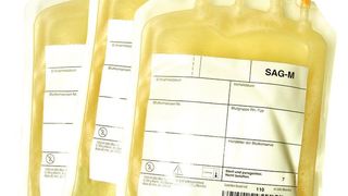 In der Blutplasmafraktionierung werden zahlreiche Prozessschritte mit der Leitfähigkeitsmessung überwacht. (Bild: reinobjektiv)