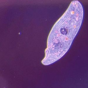 Mit etwa 8.000 verschiedenen Arten sind die Ciliaten die größte und komplexeste Gruppe der Ptotozoen (Urtierchen). Sie können winzig klein sein, gerade mal 10 Mikrometer, oder beeindruckende 4 Millimeter erreichen. Ciliaten besitzen zahlreiche haaränliche Organellen, die Cilien, die ihre Zellwand bedecken und ihnen den Namen Wimpertierchen eingebracht haben. Mit diesen Wimpern bewegen sie sich im Wasser fort, fressen und tasten; zum Beispiel, um in ihrem mikroskopisch kleinen Reich Jagd auf Bakterien und Einzeller zu machen. | Foto:&nbsp;Keshinee Apajee / IGB (Bild:  Keshinee Apajee / IGB)