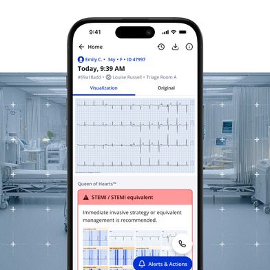 Queen of Hearts analysiert Zwölf-Kanal-EKGs auf STEMI- und STEMI-äquivalente Muster. Hervorgehobene Signalabschnitte sollen die KI-Bewertung nachvollziehbar machen (Bild: Powerful Medical / PMcardio)