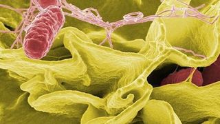 Besonders Putenfleisch ist häufig mit Erregern von Zoonosen wie Salmonellen belastet. (im Bild in rot: Salmonellen des Typs Typhimurium) (Quelle: Quelle: Rocky Mountain Laboratories, NIAID)