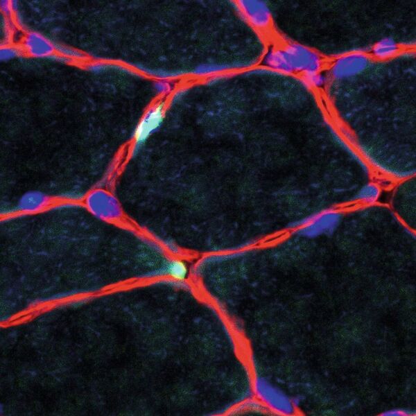 Skelettmuskulatur: Die Kerne der Muskelstammzellen sind in grün zu sehen. Die Zellkerne der Muskelfasern sind in blau, die Umgrenzung um die Muskelfasern (Basallamina) ist rot. Maßstab: 20µm. (AG Carmen Birchmeier / MDC)