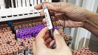 Alternsforscher haben eine Reihe von Biomarkern im menschlichen Blut identifiziert. (age mpg)