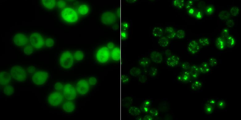 Hefezellen ohne Proteinaggregate (links) und solche mit (hell leuchtende Punkte): In Hungerzeiten dienen solche Klumpen als Zwischenlager für Proteine. (Gruppe Matthias Peter / ETH Zürich)