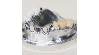 Für die Bearbeitung dentaler CAD/CAM-Materialien werden hochwertige Hartmetall-Werkzeuge mit abgestimmten Schneidgeometrien und Beschichtungen angeboten. (Emuge-Franken)
