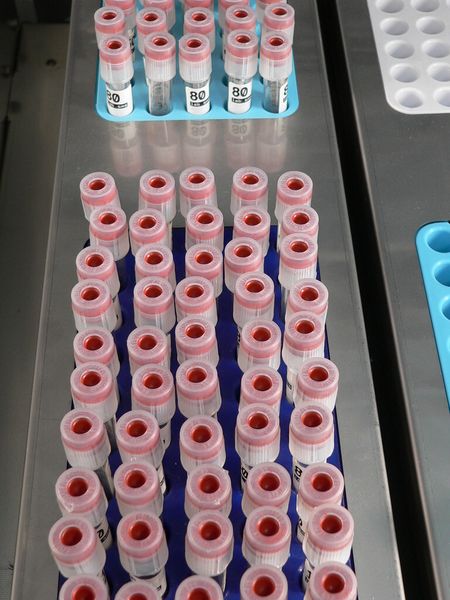 In einem großen Labor kommen an einem Morgen innerhalb von vier Stunden 20.000 Proben zusammen. (Bild: Protolabs)