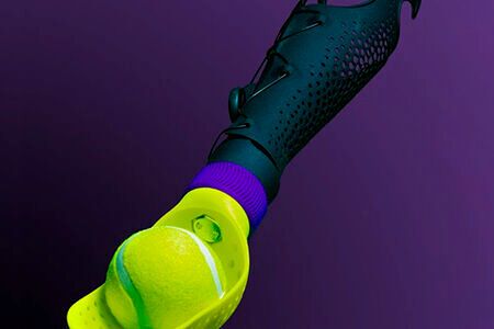 Individuell 3D-gedruckte Unterarmprothetik(Bild:  macu4 AG/Purmundus Challenge)