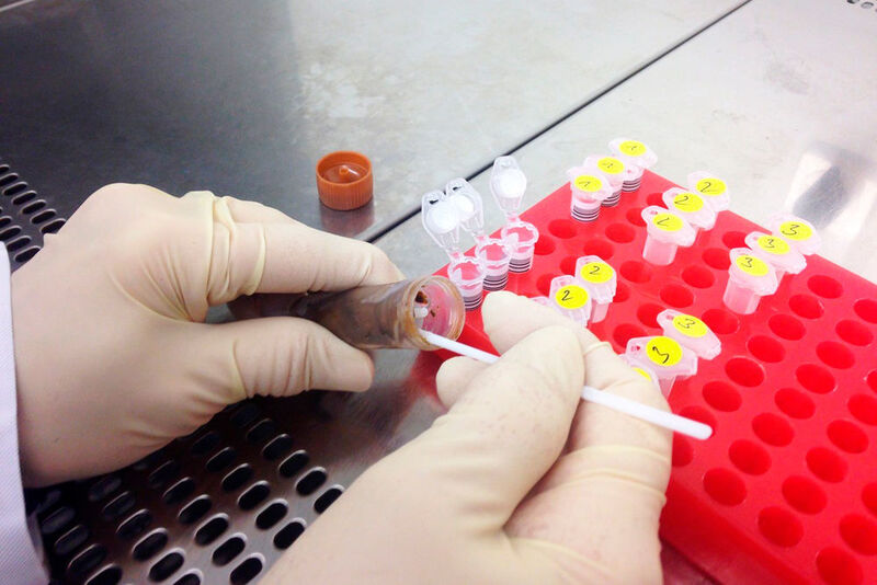 Für die Analyse der Zusammensetzung der Darmflora werden die Stuhlproben im Labor vorbereitet. ((c) Institut für Klinische Molekularbiologie/CAU)