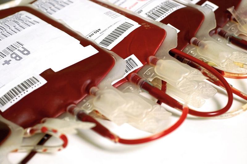 Die richtige Handhabung, Ausrüstung und das diagnostische Testverfahren sind während des gesamten Bluttransfusionsprozesses von entscheidender Bedeutung. Diese tragen dazu bei, dass eine Kontamination der jährlich weltweit gesammelten fast 112,5 Mio. Bluteinheiten verhindert wird. (Shutterstock)