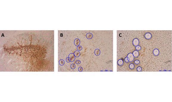 LMD für die Analyse von Neuronen im Maushirn: A. Die immunhistochemische Färbung gegen Tyrosin-Hydroxylase zeigt die dopaminergen Neurone der Substantia nigra im Maushirn (10x Objektiv). B. In größerer Vergrößerung werden einzelne dopaminerge Neurone markiert. C. Die markierten Neurone wurden mittels Lasermikrodissektion ausgeschnitten. (Archiv: Vogel Business Media)