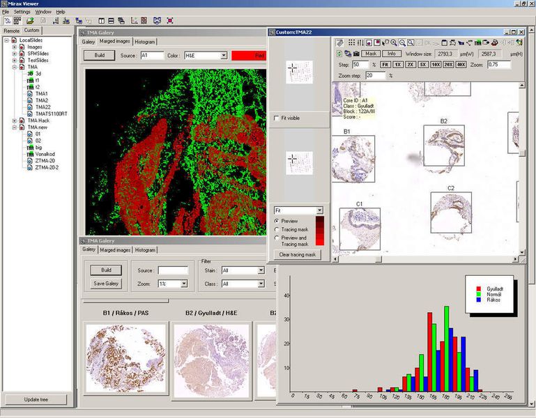4 Digital Slide-Technologie: Die Viewer Software verschafft schnell Überblick über die vorhandenen Virtual Slides.  (Bild: Carl Zeiss MicroImaging GmbH)