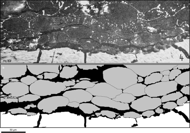 Mikroskopisches Bild weißer Fettzellen aus dem acht Millionen Jahre alten Skelett des Menschenaffen Oreopithecus bamboli aus der Toskana (Baccinello, Italien). Oben: Der Gesteinsanschliff zeigt die dicht gepackten Zellverbände. Unten: Grafische Umsetzung. (Jochen Fuß, PLoS ONE, 2018)