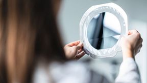 Das neue lasergestützte Verfahren macht das Schneiden von Wafern deutlich produktiver. (Bild: Trumpf)