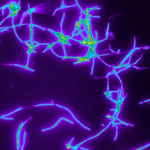 (Martin Kaltenpoth, Universität Mainz)