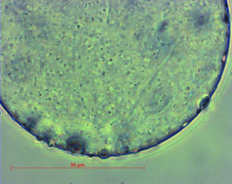 Abb. 4: Mikroskopische Aufnahme (1000x) einer Mikrokapsel nach 90-minütiger Lagerung bei pH-
Wert 2,5. (Archiv: Vogel Business Media)